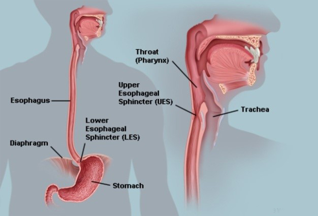lower esophageal sphincter repair
